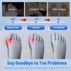 Adjustable Bunion Corrector