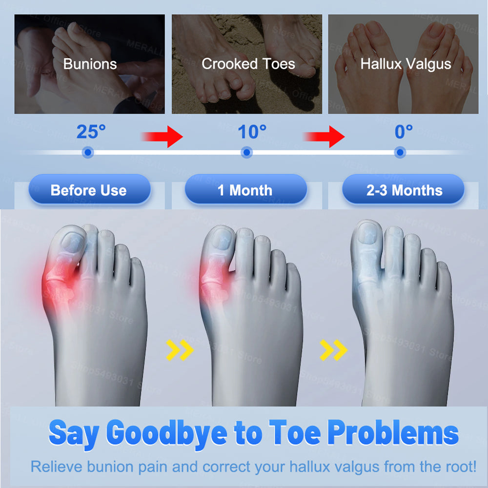 Adjustable Bunion Corrector